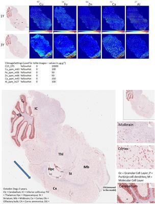 Identification of Cerebral Metal Ion Imbalance in the Brain of Aging Octodon degus